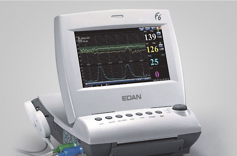       فتال مانیتورینگ(NST)