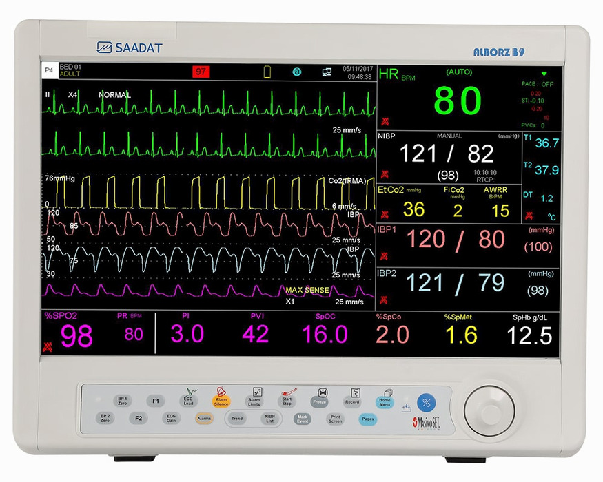   مانيتور علائم حياتي